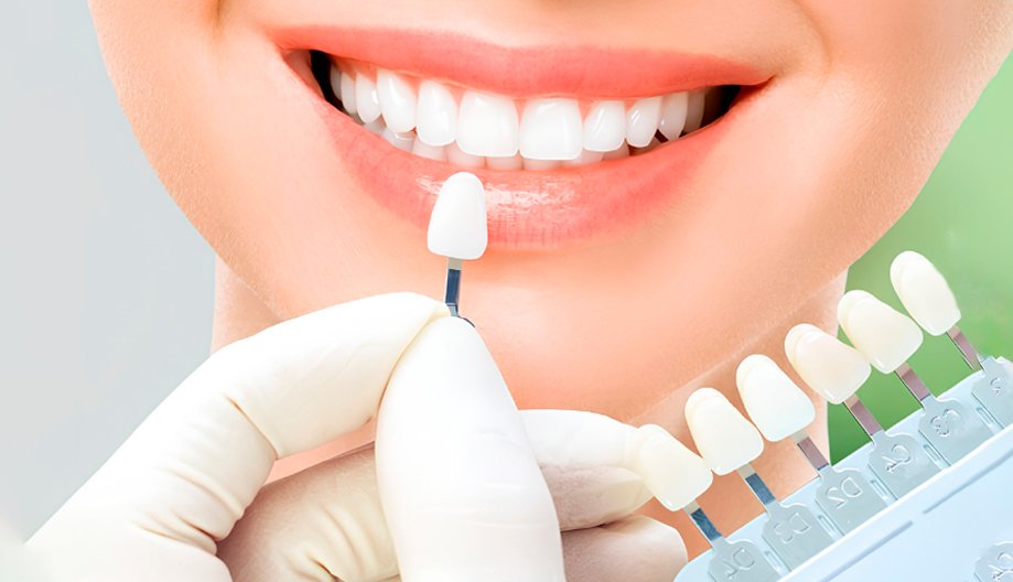 Coronas e incrustaciones dentales en una sola cita: Adiós a las esperas y los moldes molestos